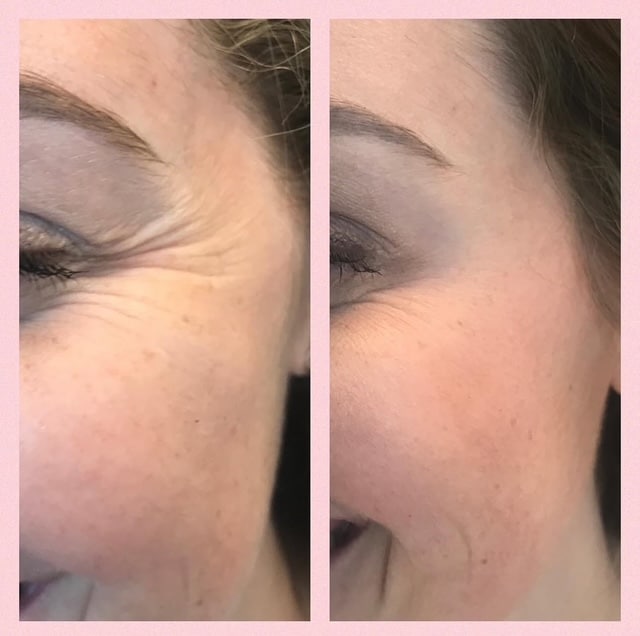 Before and After Image: Tox - left-front-oblique
