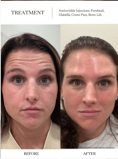 Before and After Image: Tox - front